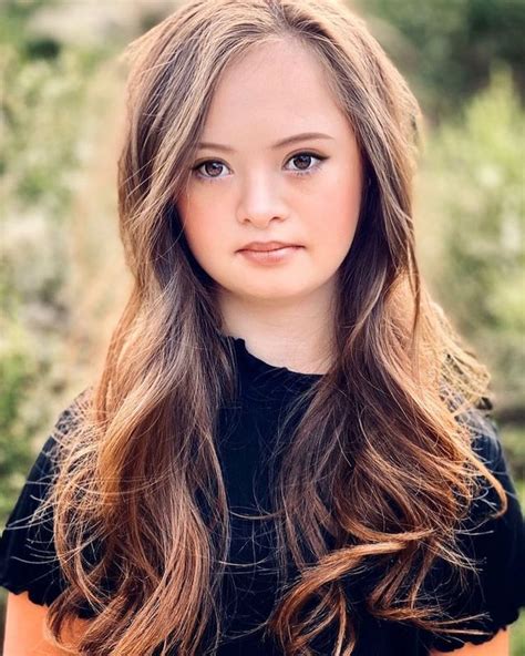 Teen model with Down syndrome featured in new 